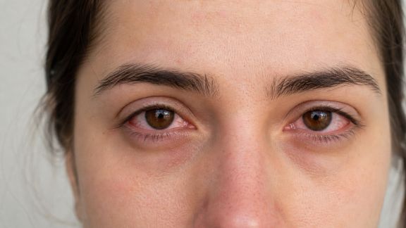 Irritations des yeux : comprendre les causes et agir efficacement