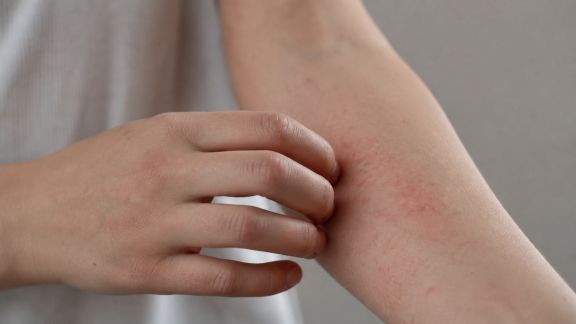 Petits maux cutanés : conseils pour apaiser irritations et démangeaisons